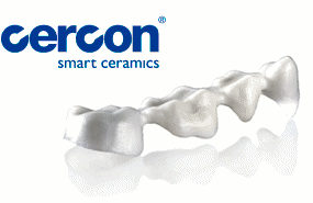 Cercon smart ceramics