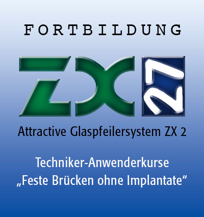 Attractive Glaspfeilersystem ZX